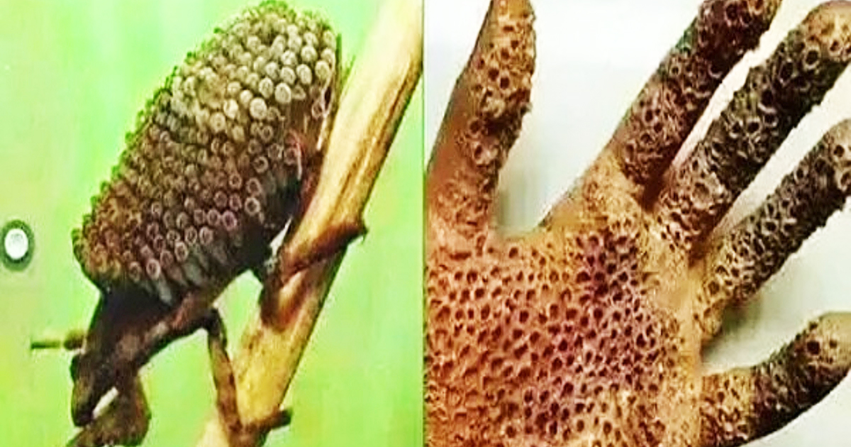 Beware Of Killer Insect That Can Burn Skin Like Acid And Cause Death Within Days