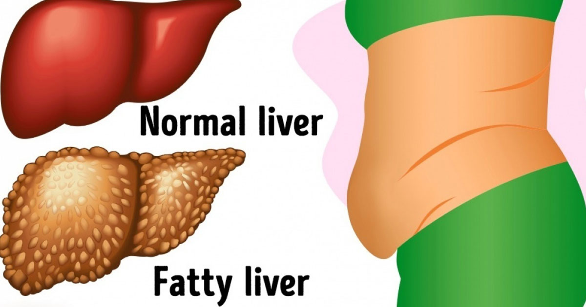 6 Warning Signs That Indicate Your Liver Is Full Of Toxins