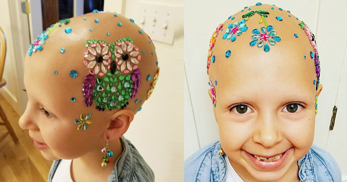 Complete Hair Loss Definitely Didn’t Stop This 7-Year-Old Girl From Winning Her School’s Crazy Hair Day